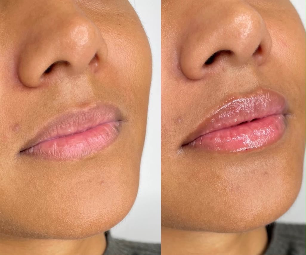 Bena at Éclat Aesthetics